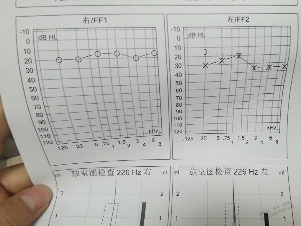 耳闷结果 - 线报酷
