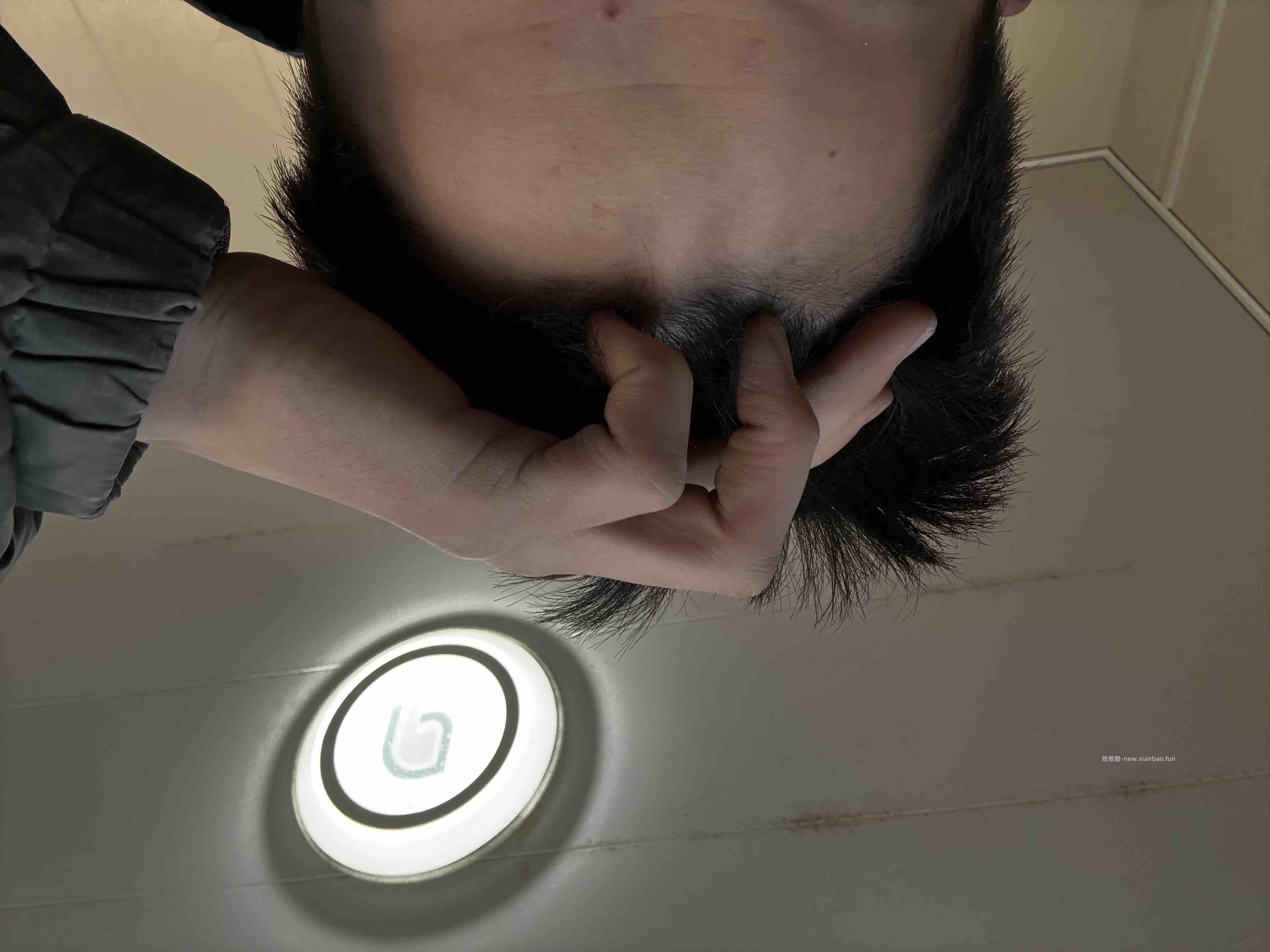 额头上面出现两道筋咋回事！ - 线报酷