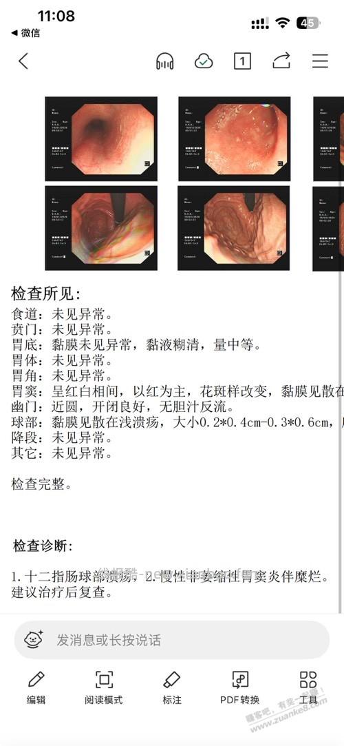 感觉得了焦虑症 - 线报酷