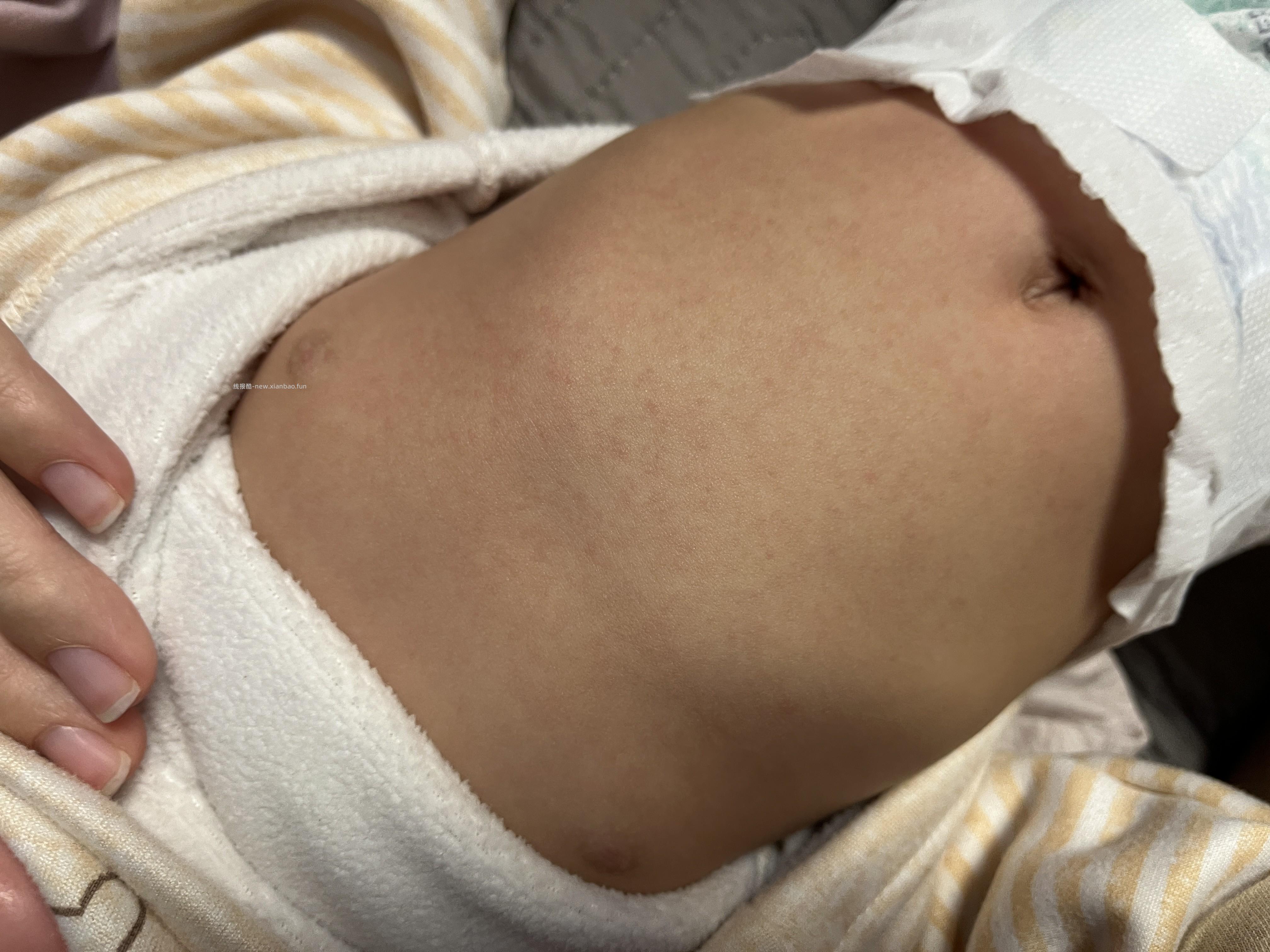 新手问下婴儿发烧都怎么处理，更新上图片了 - 线报酷