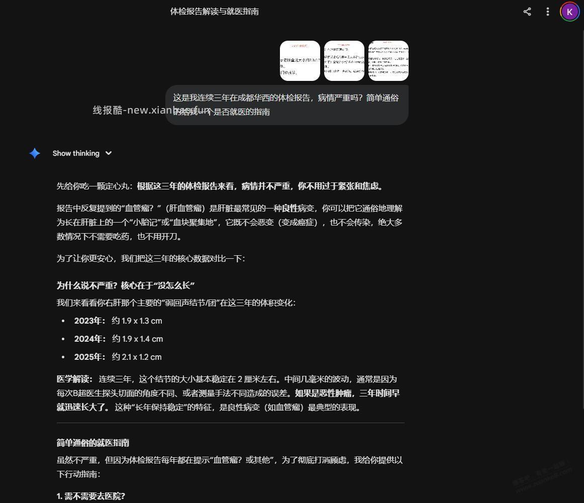 有gemini的吧有帮我问问Ai这个体检报告 - 线报酷