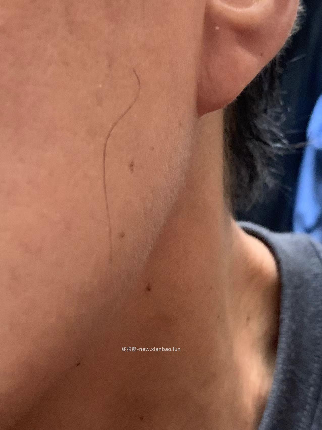 脸上长毛怎么办 - 线报酷