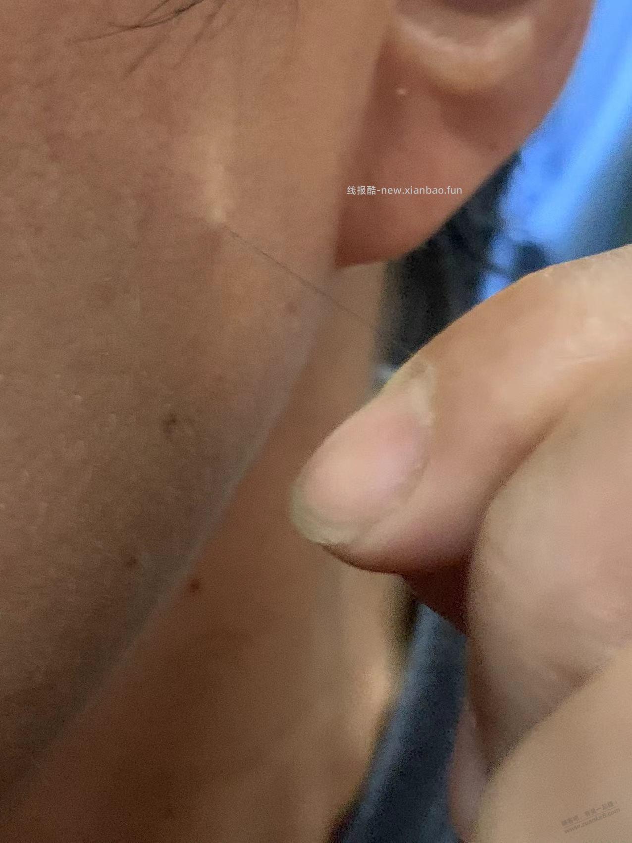 脸上长毛怎么办 - 线报酷