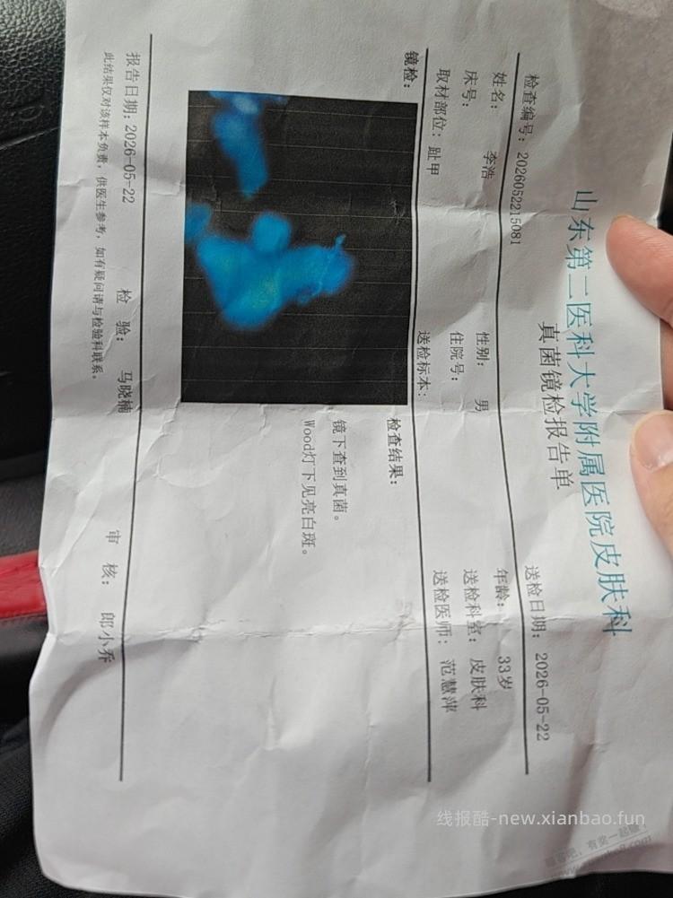 吧里有甲癣 治好的吗？哎喝了7个疗程 伊曲康挫了还没好 愁死了 - 线报酷