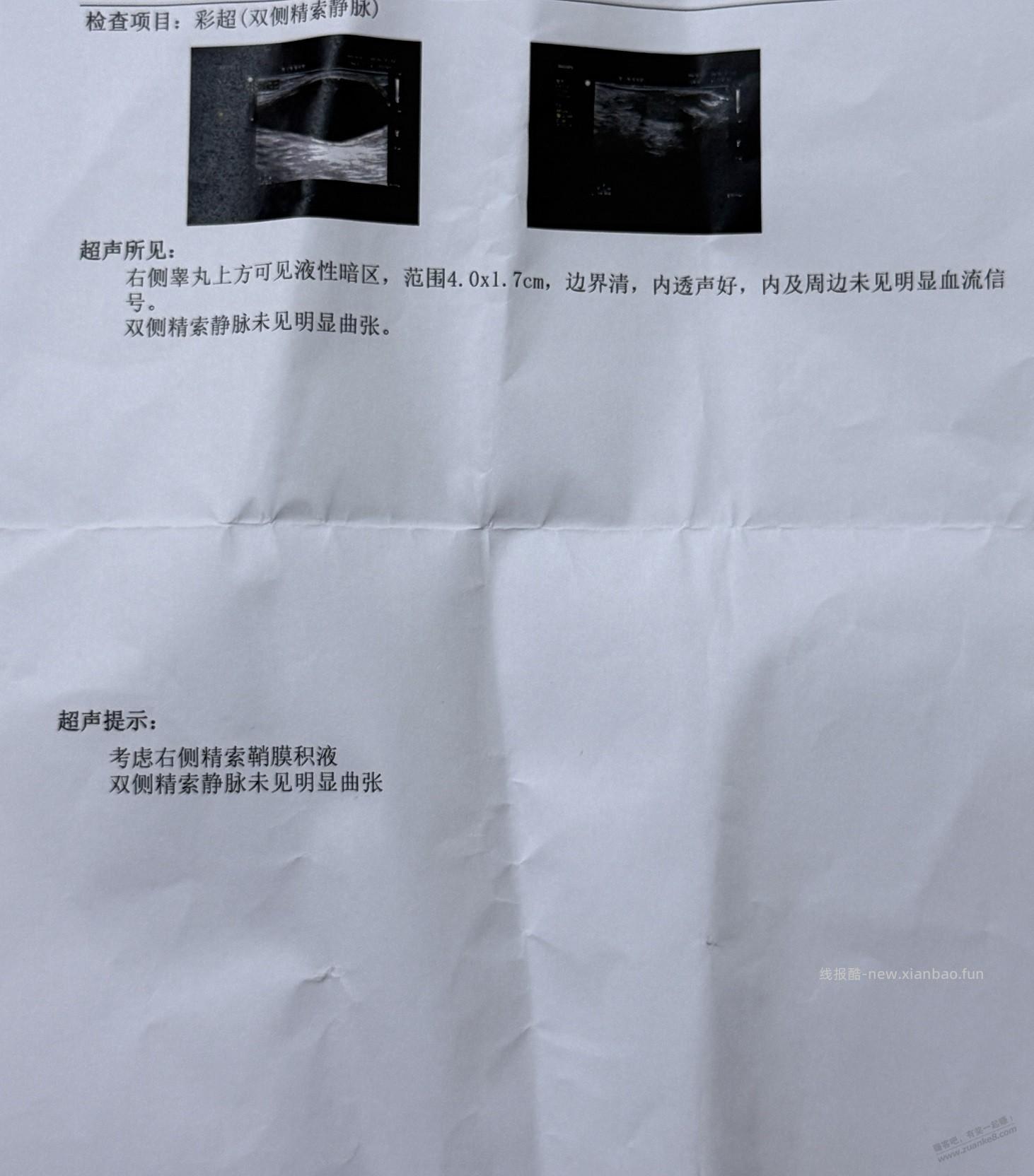 天塌了，4岁男孩蛋蛋那精索鞘膜积液，吧医帮忙看看好吗 - 线报酷