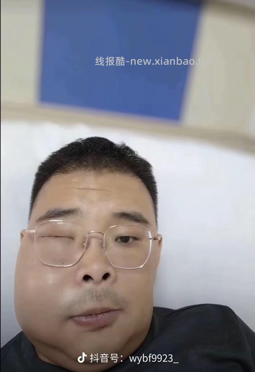 拔牙后几天真难熬 阻生智齿 帮助大家下次搜索有数据 - 线报酷