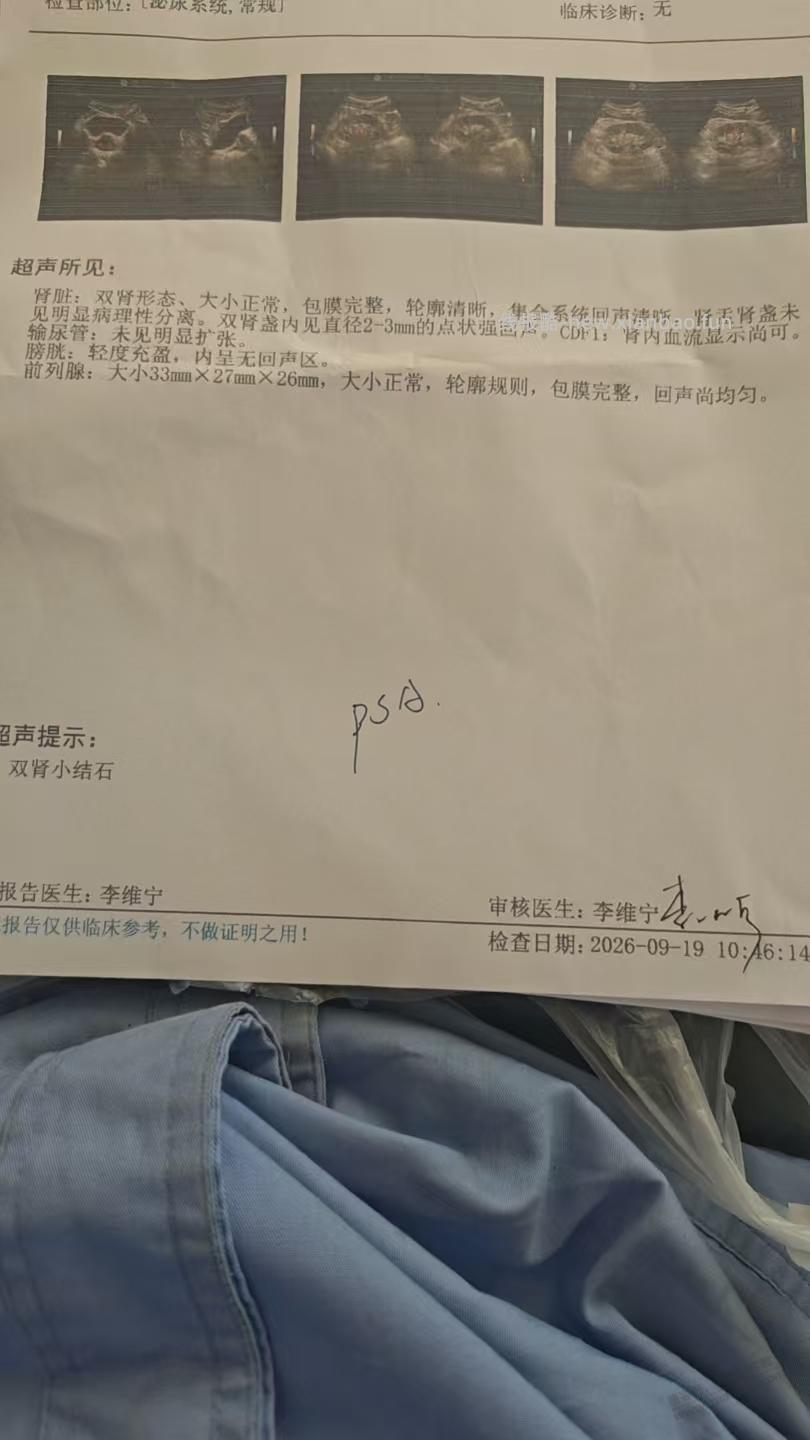 医生让我做psa，好担心！！！ - 线报酷
