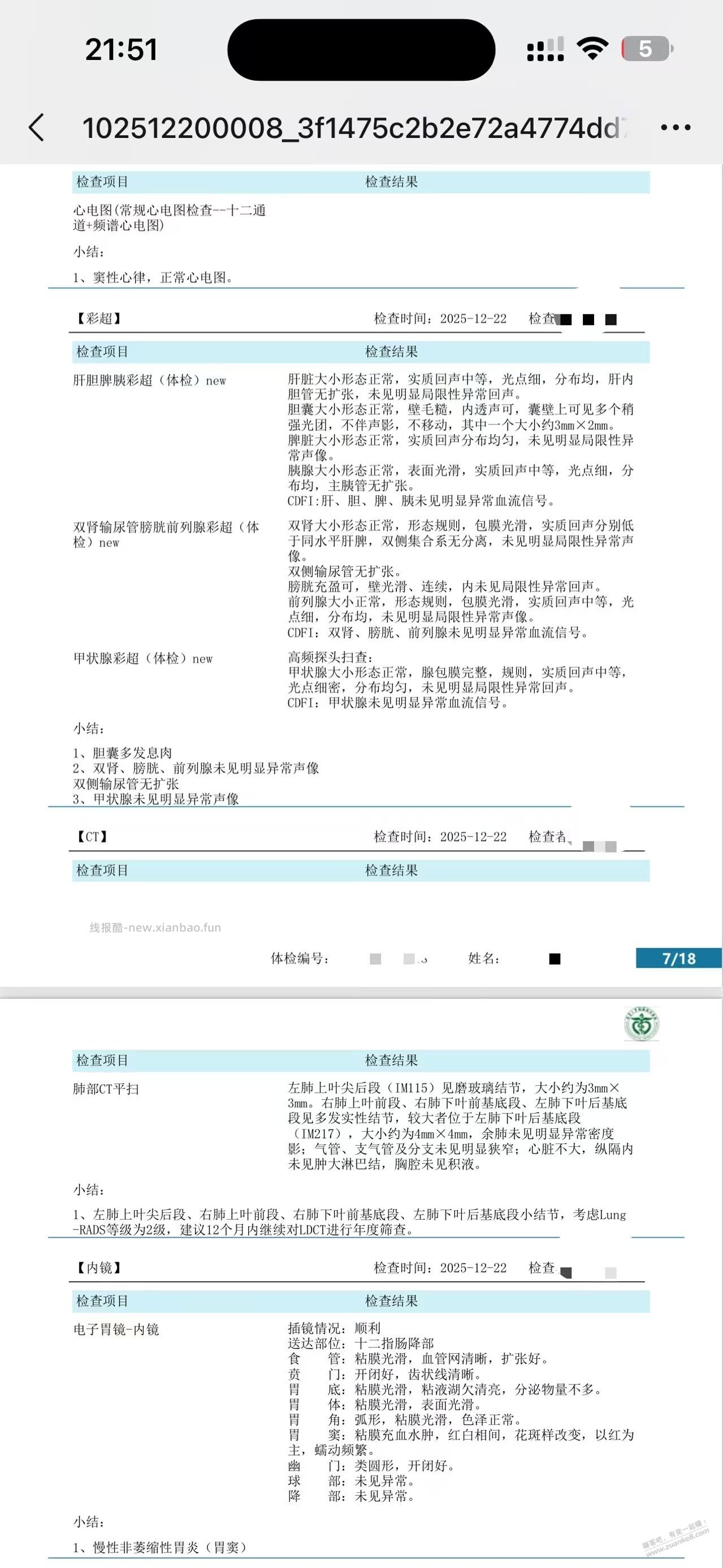 吧医帮我看看体检报告 - 线报酷 吧医帮我看看体检报告 - 线报酷