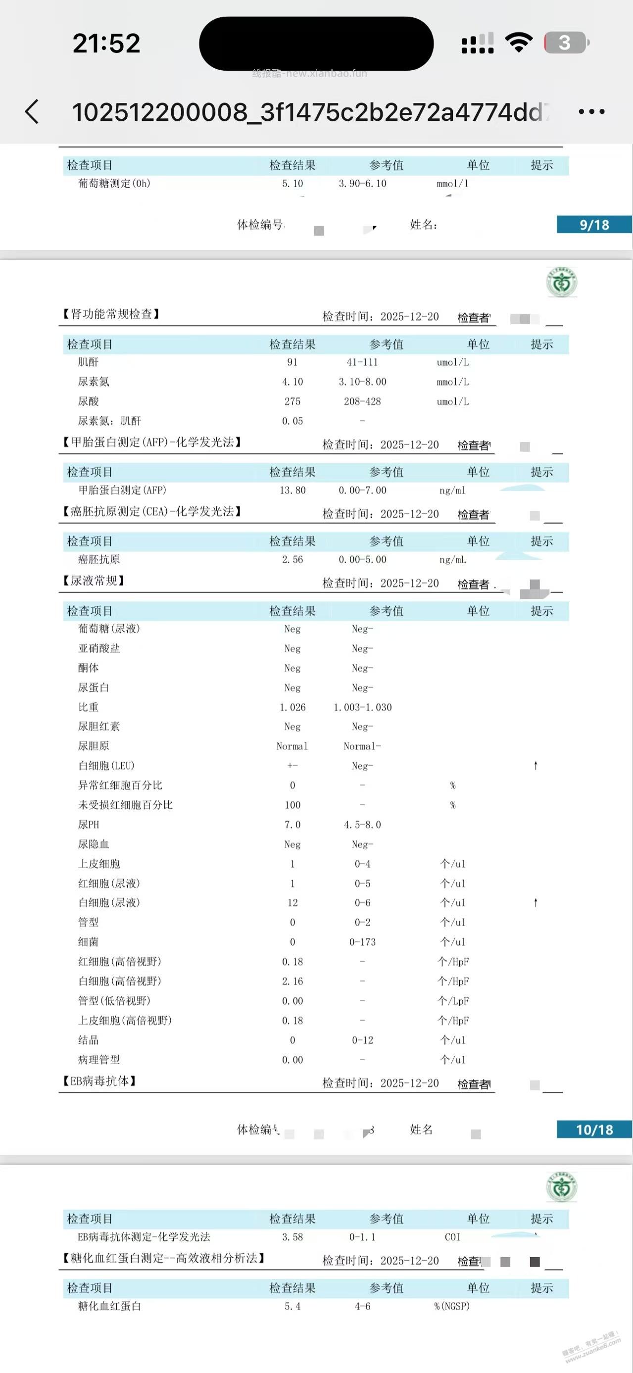 吧医帮我看看体检报告 - 线报酷 吧医帮我看看体检报告 - 线报酷