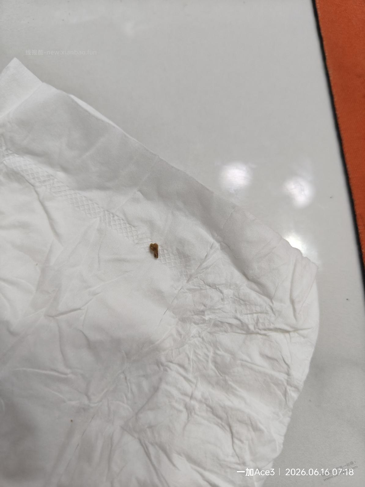 吧里肾结石,输尿管结石的看过来,干货 - 线报酷 吧里肾结石,输尿管结石的看过来,干货 - 线报酷