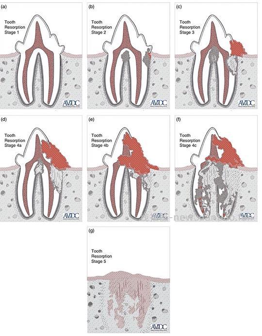 【科普】[养猫笔记05-医疗] 猫牙破齿细胞吸收性损伤（FORL）— 猫第二大常见疾病 - 线报酷