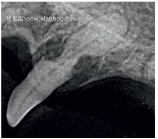 【科普】[养猫笔记05-医疗] 猫牙破齿细胞吸收性损伤（FORL）— 猫第二大常见疾病 - 线报酷