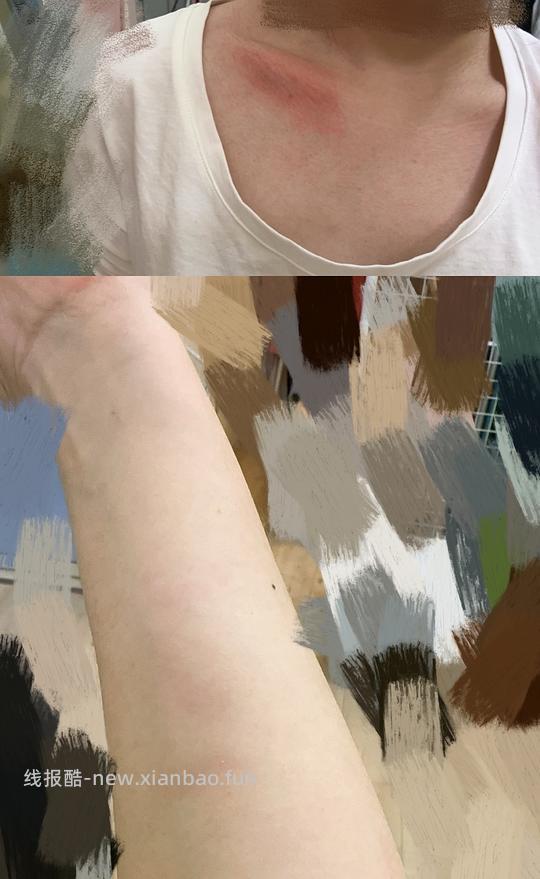 讨论/【科普】关于猫毛过敏患者养猫的必备措施及脱敏办法（附医院清单🏥 - 线报酷