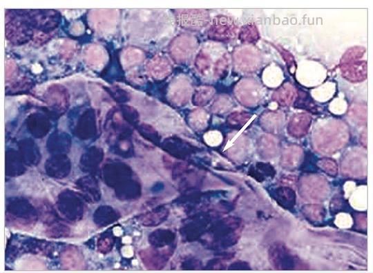 【科普】猫淋巴瘤概述（2） - 线报酷
