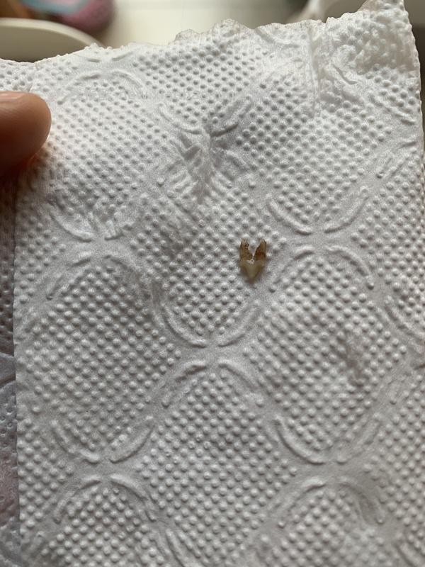 【科普】牙科问题和普通内科问题都可以留言，看到会回复 - 线报酷