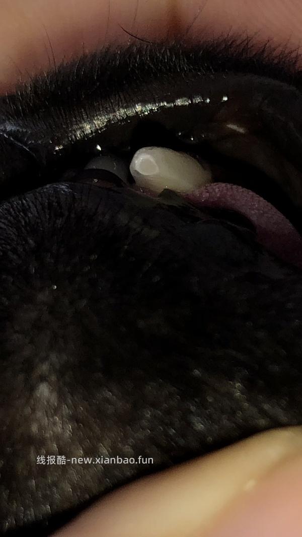 【科普】牙科问题和普通内科问题都可以留言，看到会回复 - 线报酷