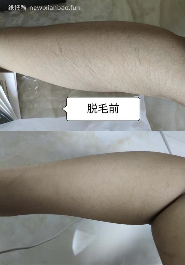 简单作业，康佳脱毛仪129，叠省省卡或plus优惠券 - 线报酷