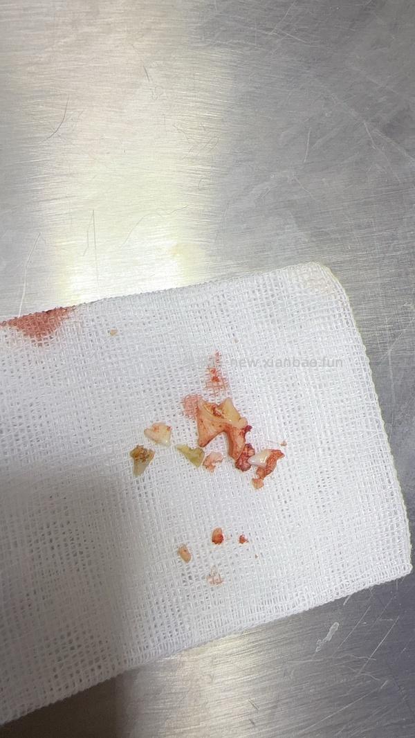 讨论/【科普】八岁小猫牙吸收 拔牙经验分享 - 线报酷