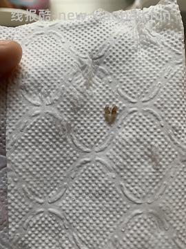 【科普】牙科问题和普通内科问题都可以留言，看到会回复 - 线报酷