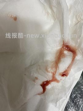 【科普】我如何发现小猫得了隐匿的鼻腔恶性肿瘤？重视“流鼻涕”！ - 线报酷