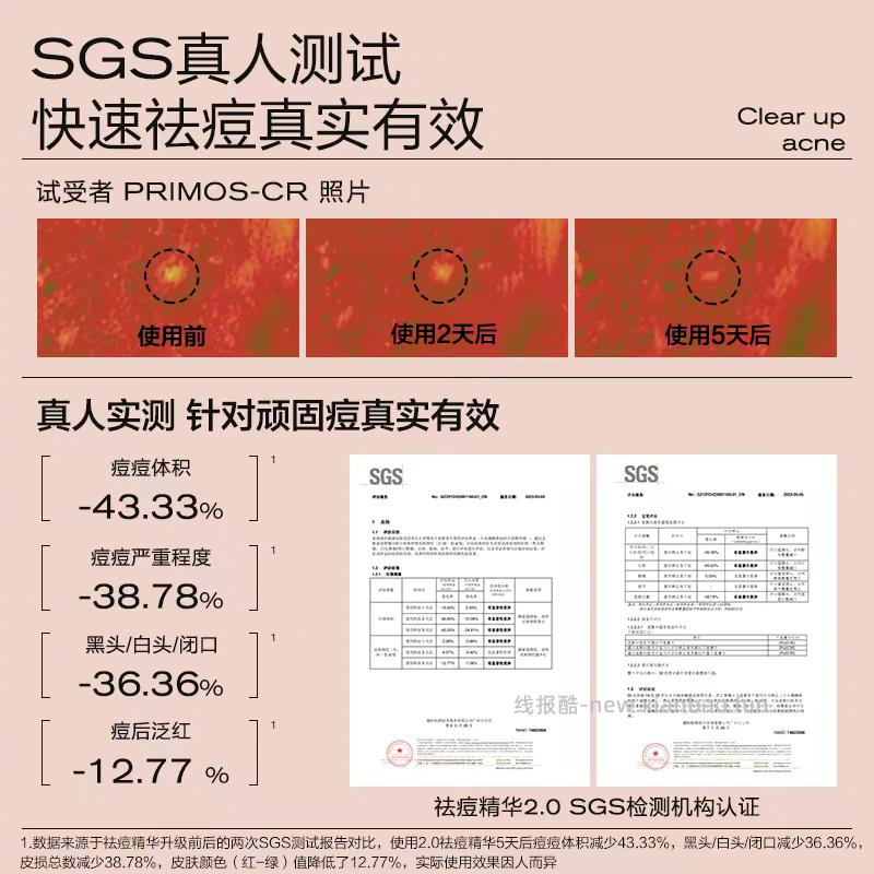 大水滴 3点祛痘精华2.0 7ml+3点特舒精华1ml*3连包 34元 - 线报酷