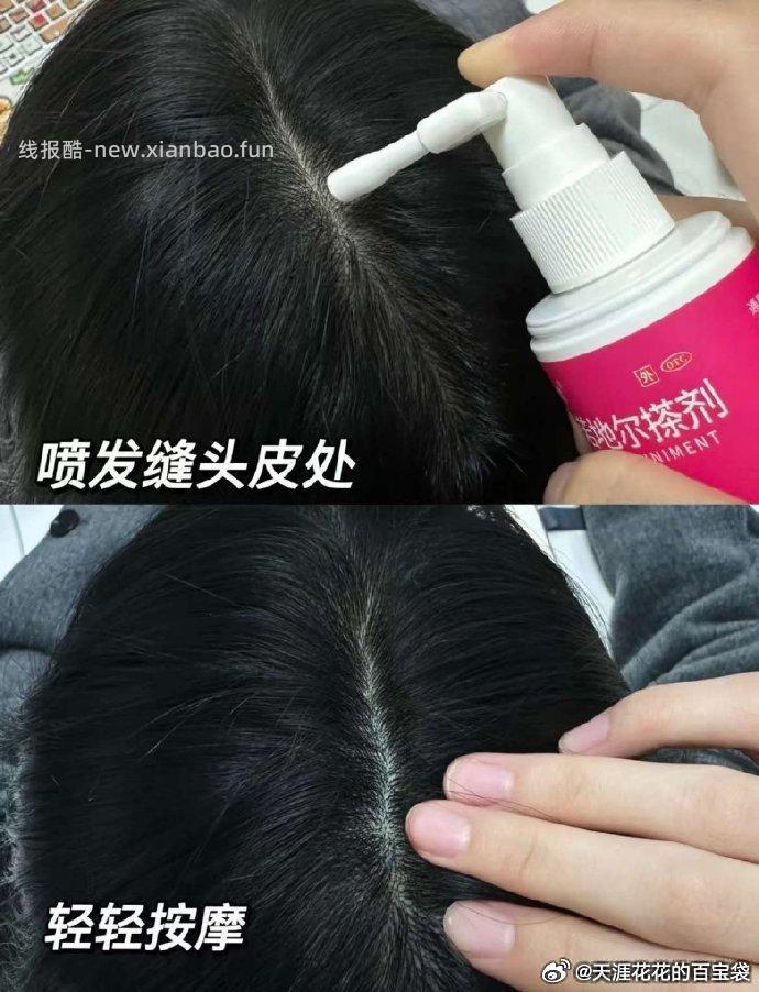 达霏欣米诺地尔2%酊搽搓剂30ml 43元 - 线报酷