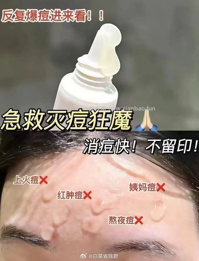 芙清医用祛痘凝胶2支 29.9元 - 线报酷