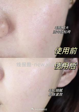 薇诺娜舒敏保湿润肤水90ml拍3件 39.99元 - 线报酷