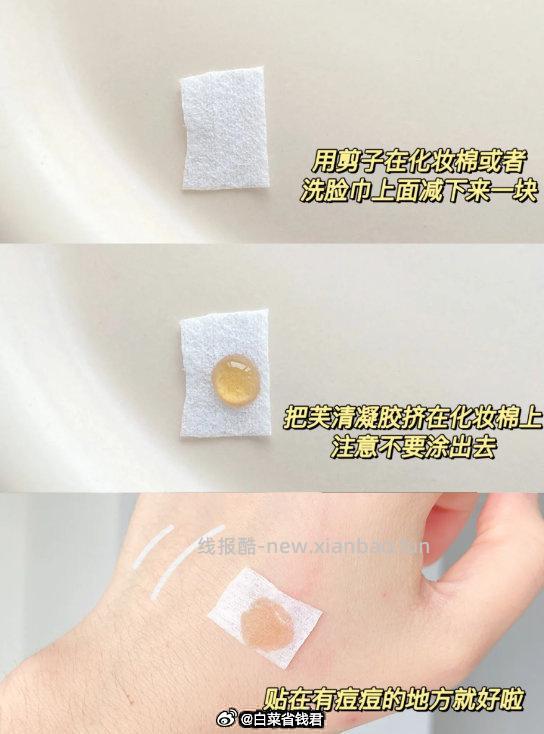 芙清医用祛痘凝胶2支 拍2件 29.9元 - 线报酷