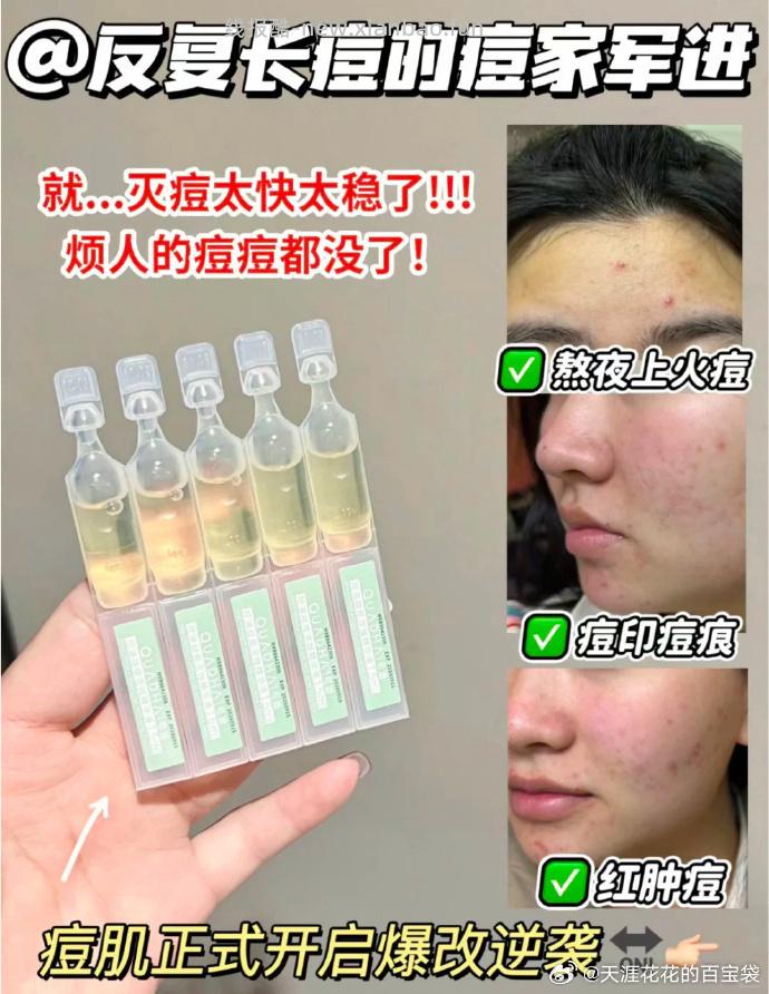 夸迪战痘次抛精华液*30支 67元 - 线报酷