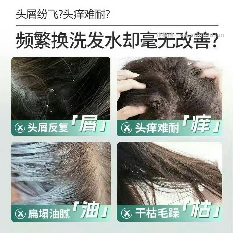 舒蕾氧活去屑洗发露400g*3瓶+赠品 49元 - 线报酷