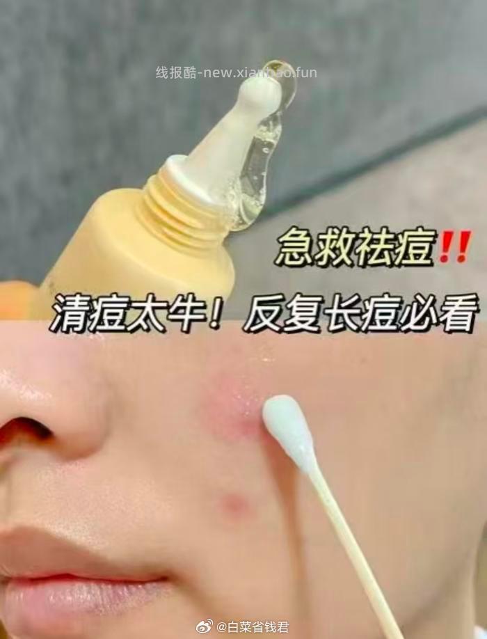 19.8 花印 进口祛痘凝露精华凝胶25g 急救去痘王 有小伙伴反馈 效果很明显 - 线报酷