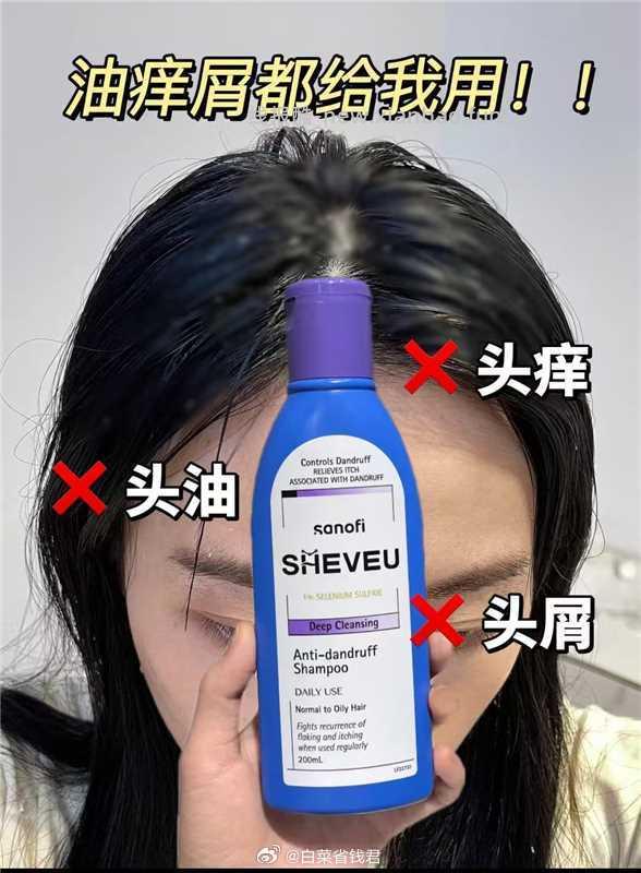 赛逸二硫化硒去屑洗发水拍2件 27元/瓶 - 线报酷